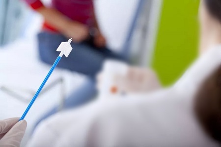 پیشرفت در غربالگری سرطان دهانه رحم: نقش تست های HPV خود جمع آوری