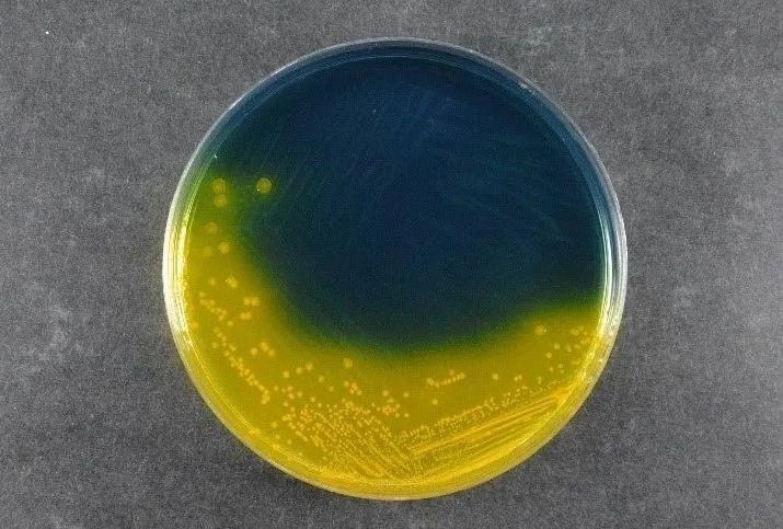 اطمینان از ایمنی مواد غذایی: Salmonella Shigella Agar Babio (SS) از استانداردهای جهانی تشخیص پاتوژن پشتیبانی می کند