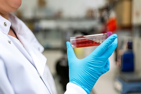 Babio برای حمل و نقل نمونه بالینی قابل اعتماد ، Media Liquid Amies را راه اندازی می کند