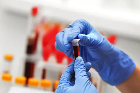 تشخیص سریع مالاریا: کیت تست آنتی ژن دوگانه BABIO سلامت جهانی را تقویت می کند